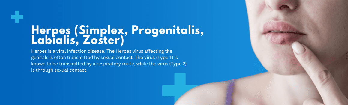 Herpes (Simplex, Progenitalis, Labialis, Zoster) - Ovihams