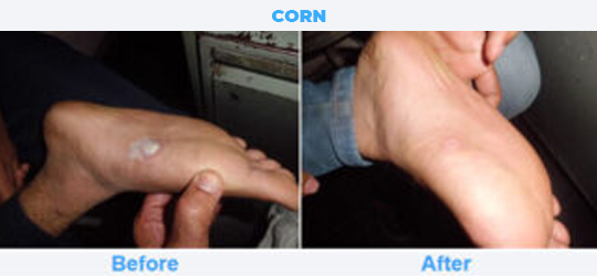 CORN